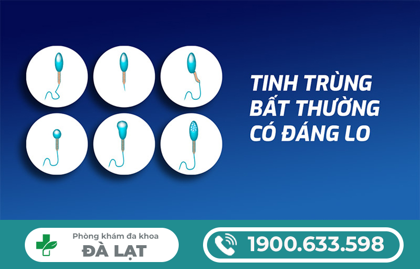 TINH TRÙNG CHẾT LÀ GÌ? DẤU HIỆU NAM GIỚI CẦN BIẾT