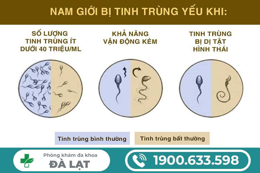 TINH TRÙNG YẾU Ở NAM GIỚI: 10 NGUYÊN NHÂN PHỔ BIẾN ÍT AI BIẾT 