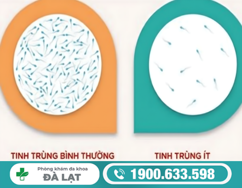 PHƯƠNG PHÁP ĐIỀU TRỊ TINH TRÙNG ÍT HIỆU QUẢ HIỆN NAY