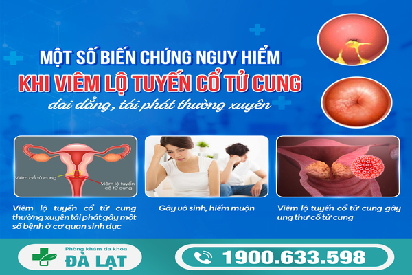 Ảnh Hưởng Của Viêm Lộ Tuyến Cổ Tử Cung 