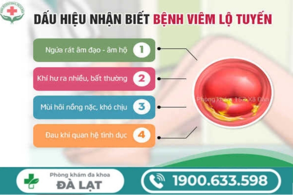 Biểu Hiện Của Viêm Lộ Tuyến Cổ Tử Cung 