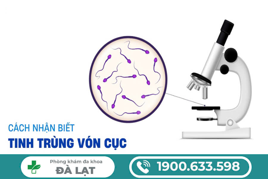 TINH TRÙNG VÓN CỤC CÓ CHỮA ĐƯỢC KHÔNG? GIẢI ĐÁP CỦA BÁC SĨ CHUYÊN KHOA