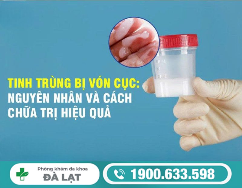 TINH TRÙNG VÓN CỤC Ở NAM GIỚI: NGUYÊN NHÂN VÀ CÁCH ĐIỀU TRỊ HIỆN NAY 