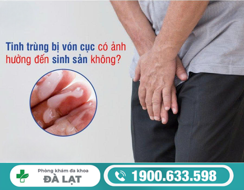 TINH TRÙNG VÓN CỤC CÓ SAO KHÔNG? DẤU HIỆU VÀ NGUY CƠ CẦN BIẾT 