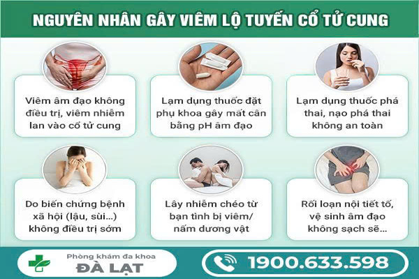 Nguyên Nhân Bị Viêm Lộ Tuyến Cổ Tử Cung 