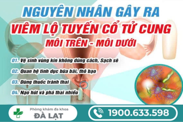 Viêm Lộ Tuyến Cổ Tử Cung Môi Trên, Môi Dưới 
