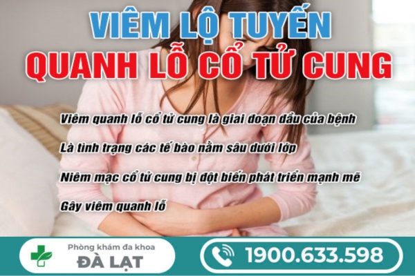 Viêm Lộ Tuyến Quanh Lỗ Cổ Tử Cung 
