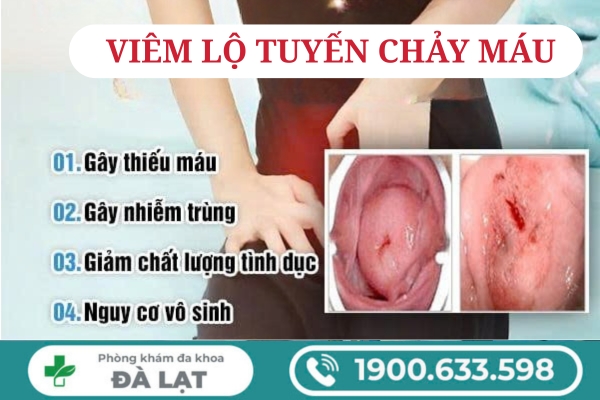 Viêm Lộ Tuyến Chảy Máu 