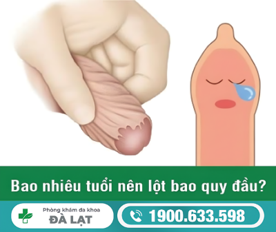 ĐỘ TUỔI LỘT BAO QUY ĐẦU AN TOÀN VÀ HẠN CHẾ BIẾN CHỨNG