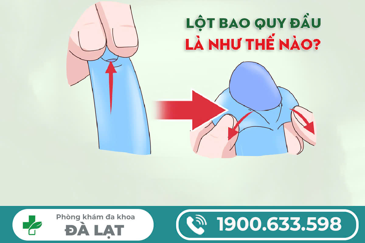 CÓ NÊN LỘT BAO QUY ĐẦU KHÔNG? LỜI KHUYÊN TỪ CHUYÊN GIA NAM KHOA
