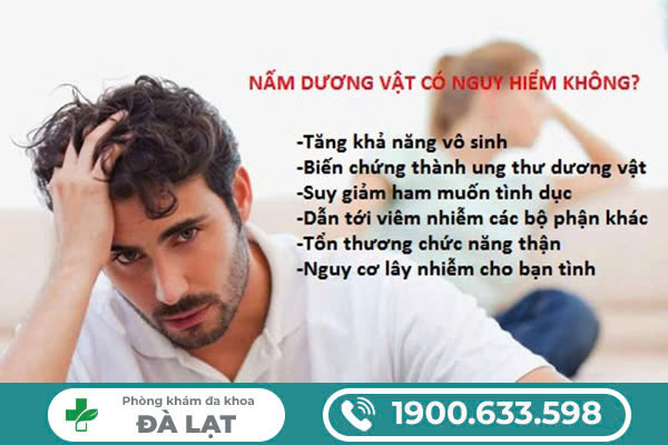 NẤM DƯƠNG VẬT Ở NAM GIỚI: KHI NÀO CẦN ĐI KHÁM BÁC SĨ?
