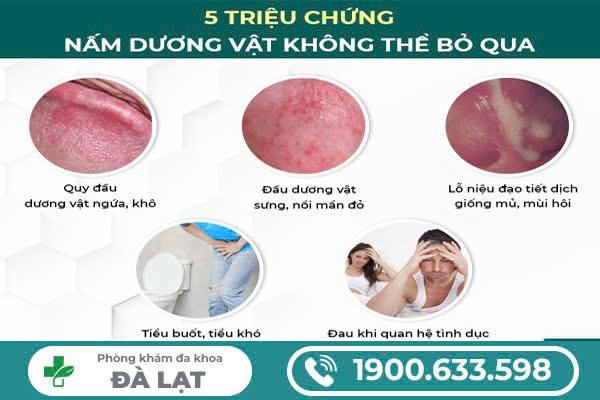 DẤU HIỆU NẤM DƯƠNG VẬT Ở NAM GIỚI DỄ NHẬN BIẾT SỚM