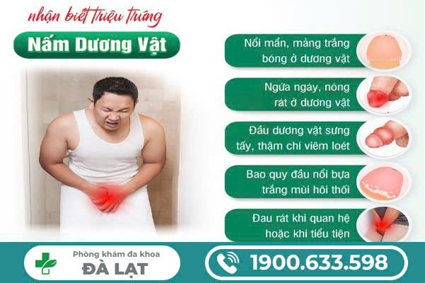 ĐIỀU TRỊ NẤM DƯƠNG VẬT Ở NAM GIỚI BẰNG PHƯƠNG PHÁP HIỆU QUẢ HIỆN NAY