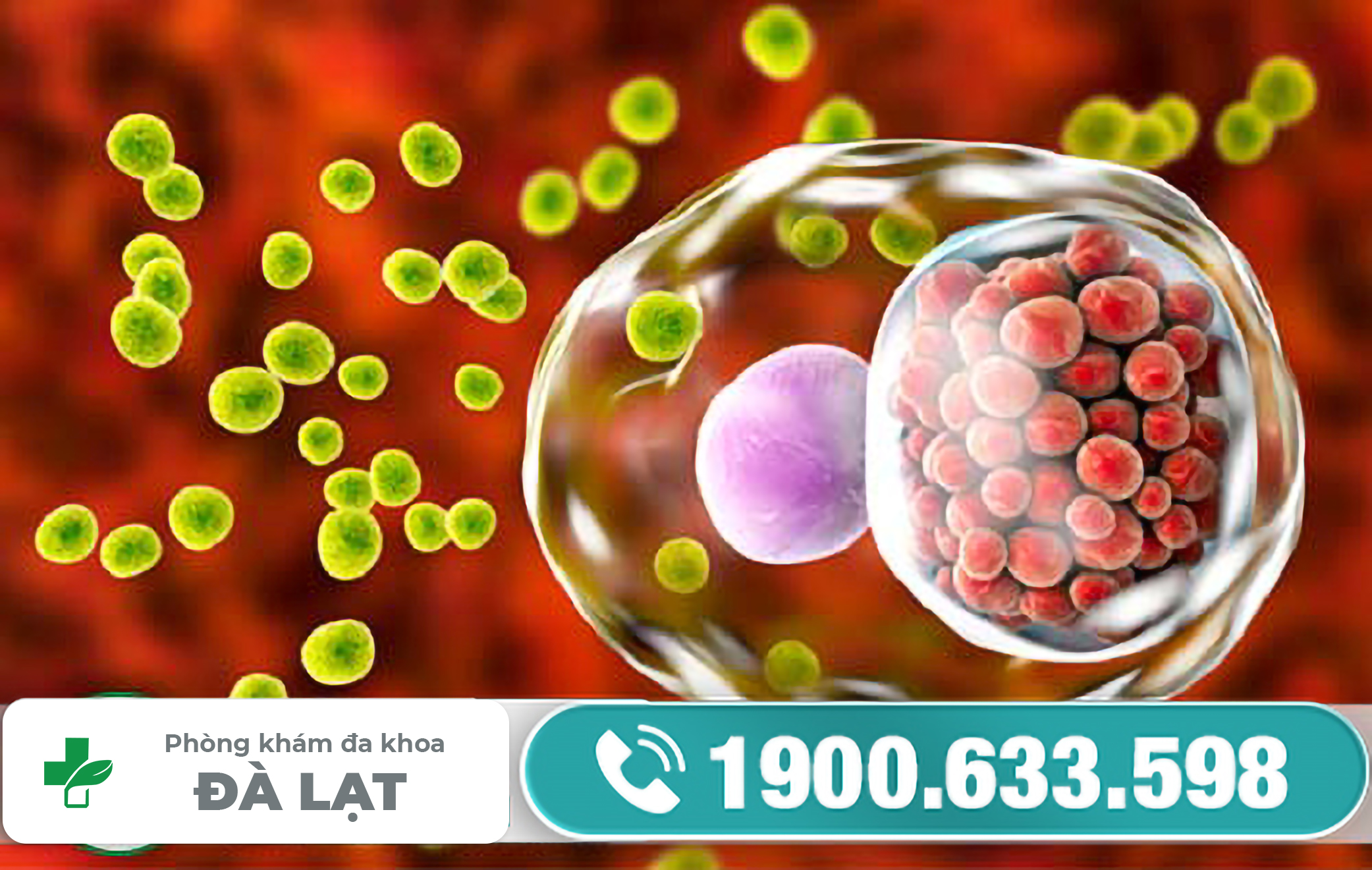 Xét Nghiệm Chlamydia uy tín ở đâu ? 