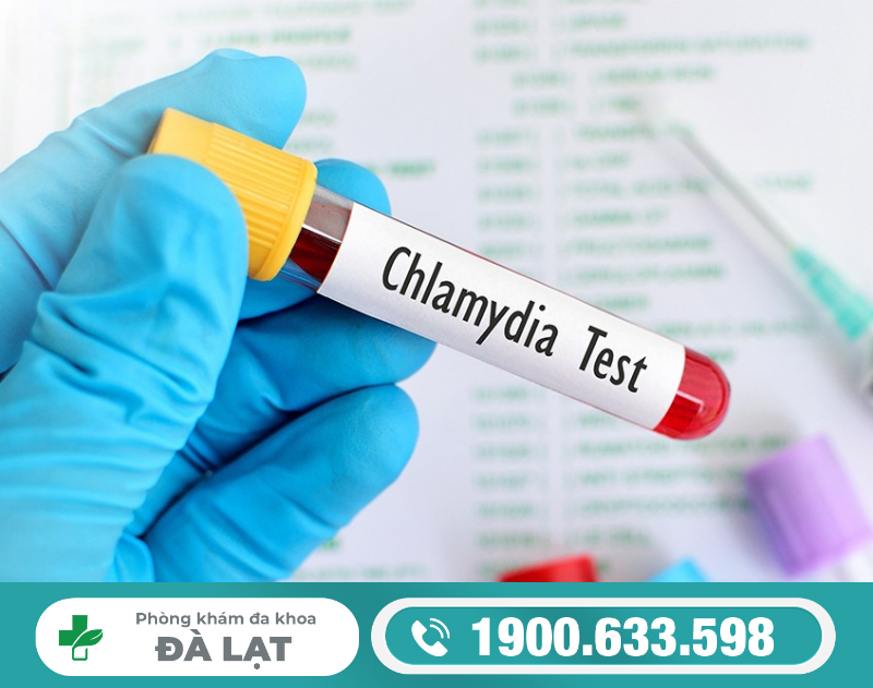 Chlamydia lây qua đường nào ? 