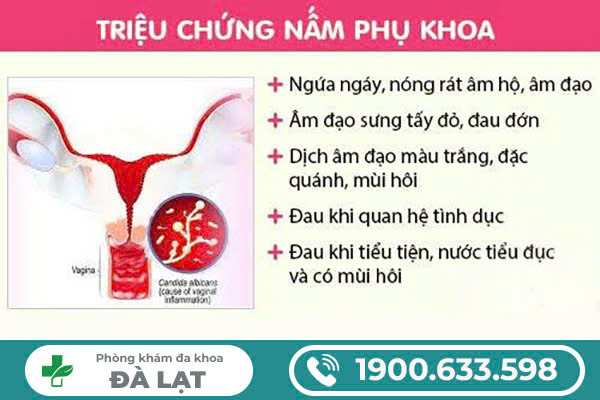 Tìm Hiểu Về: Nấm Phụ Khoa 