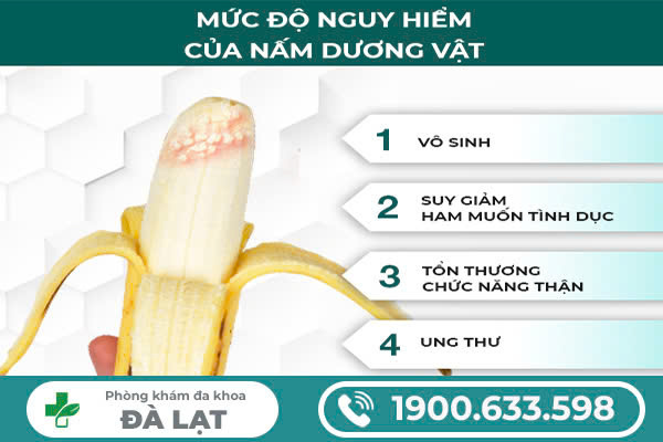 NẤM DƯƠNG VẬT CÓ NGUY HIỂM KHÔNG? NHỮNG ĐIỀU NAM GIỚI CẦN BIẾT