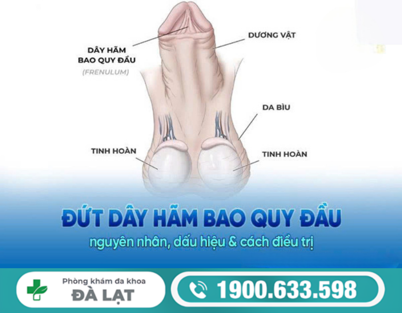 ĐỨT DÂY HÃM QUY ĐẦU: NGUYÊN NHÂN VÀ CÁCH ĐIỀU TRỊ HIỆU QUẢ 