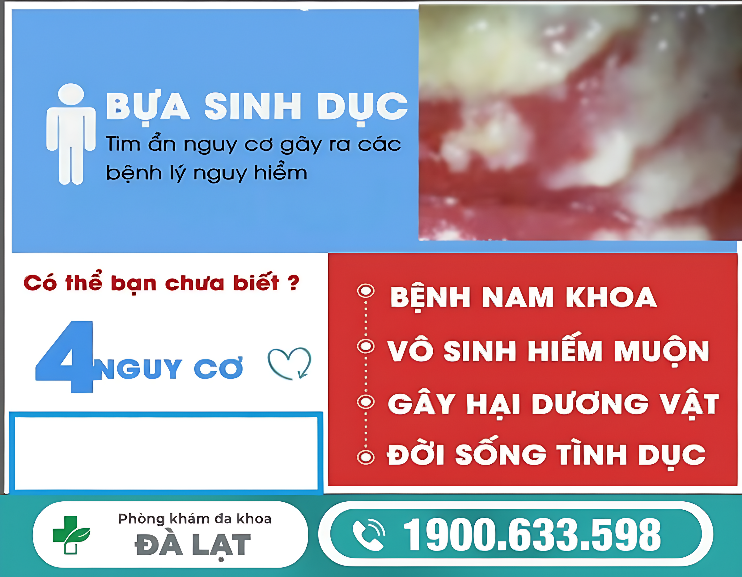 BỰA SINH DỤC CÓ NGUY HIỂM KHÔNG? CHUYÊN GIA GIẢI THÍCH CHI TIẾT