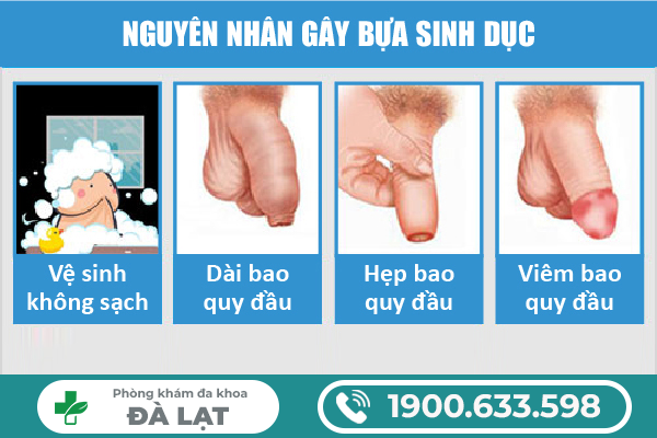 CÁCH ĐIỀU TRỊ BỰA SINH DỤC HIỆU QUẢ CHO NAM GIỚI HIỆN NAY 