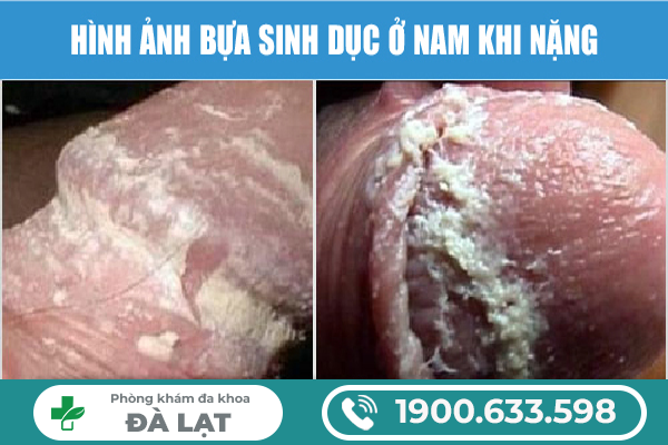 BỰA SINH DỤC CÓ NGUY HIỂM KHÔNG? DẤU HIỆU CẢNH BÁO BẠN CẦN BIẾT