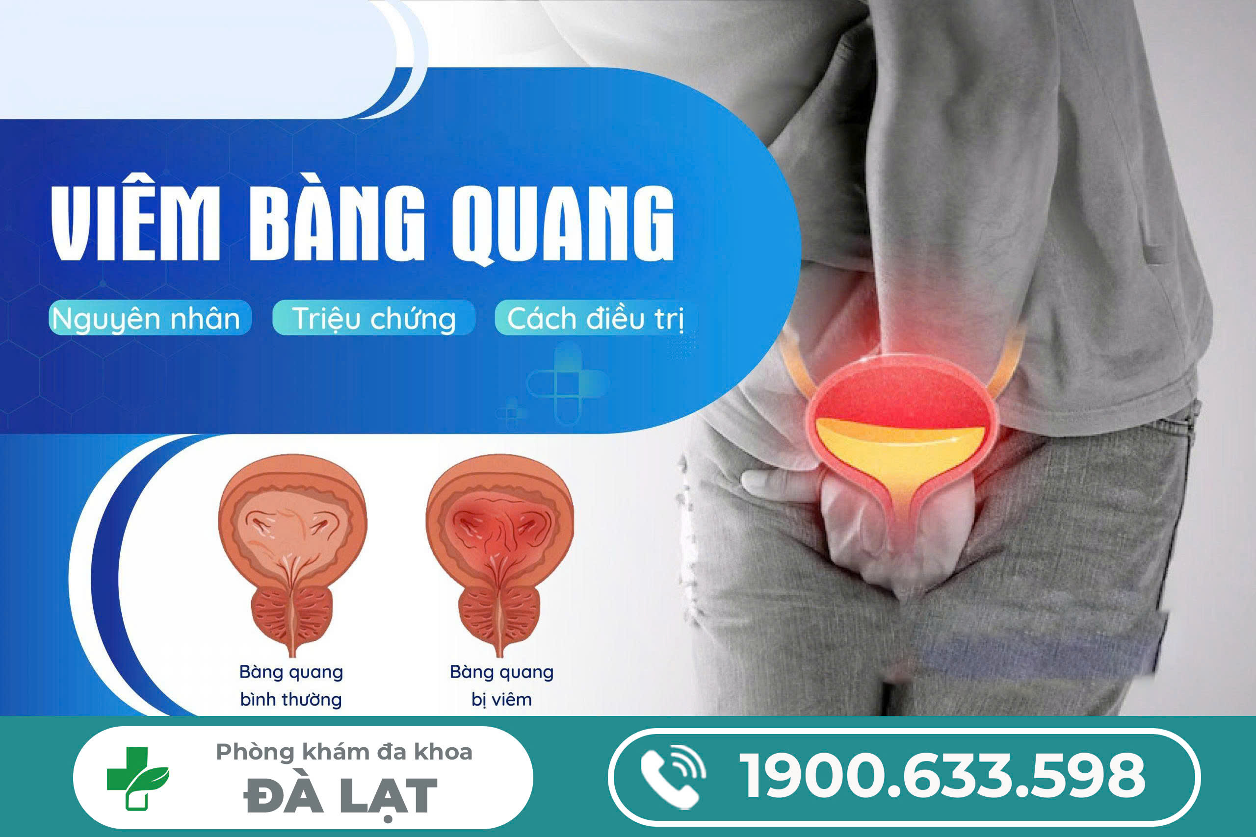 CÁCH CHỮA VIÊM BÀNG QUANG Ở NAM GIỚI HIỆU QUẢ HIỆN NAY 