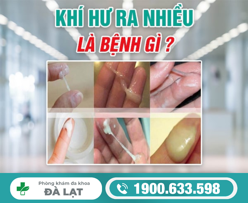 Khí Hư Ra Nhiều Là Bệnh Gì ? 
