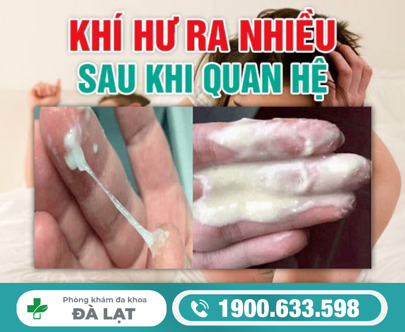 Khí Hư Ra Nhiều Sau Khi Quan Hệ 