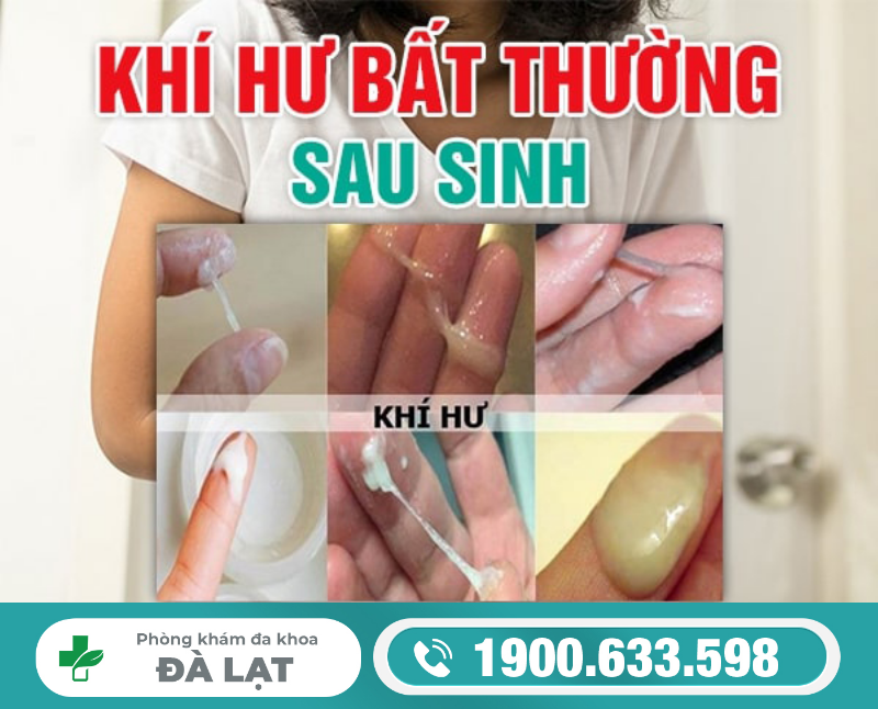 Khí Hư Bất Thường Sau Sinh 