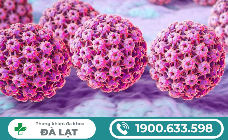 Bệnh lây qua đường tình dục/bệnh STDS . NHỮNG ĐIỀU CẦN BIẾT ĐỂ PHÒNG TRÁNH LÂY BỆNH STDS