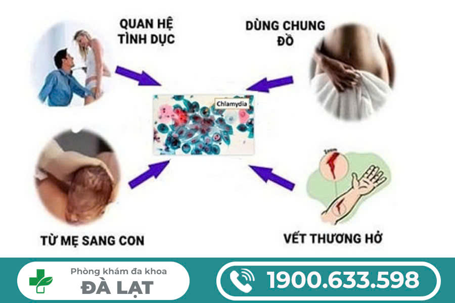 CHLAMYDIA LÂY QUA NHỮNG ĐƯỜNG NÀO