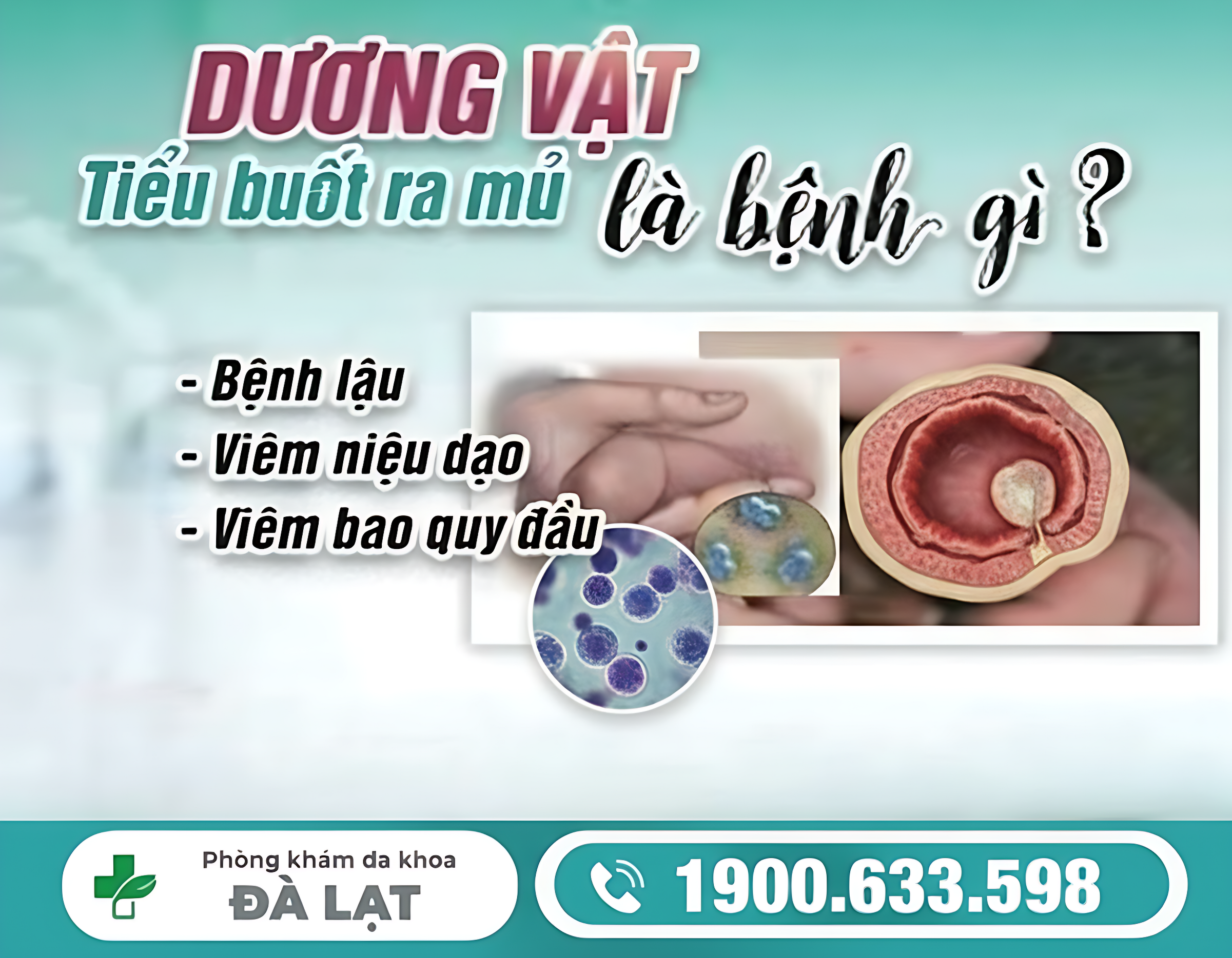 NAM GIỚI TIỂU BUỐT CÓ MỦ Ở DƯƠNG VẬT: DẤU HIỆU BỆNH LÝ NAM KHOA 