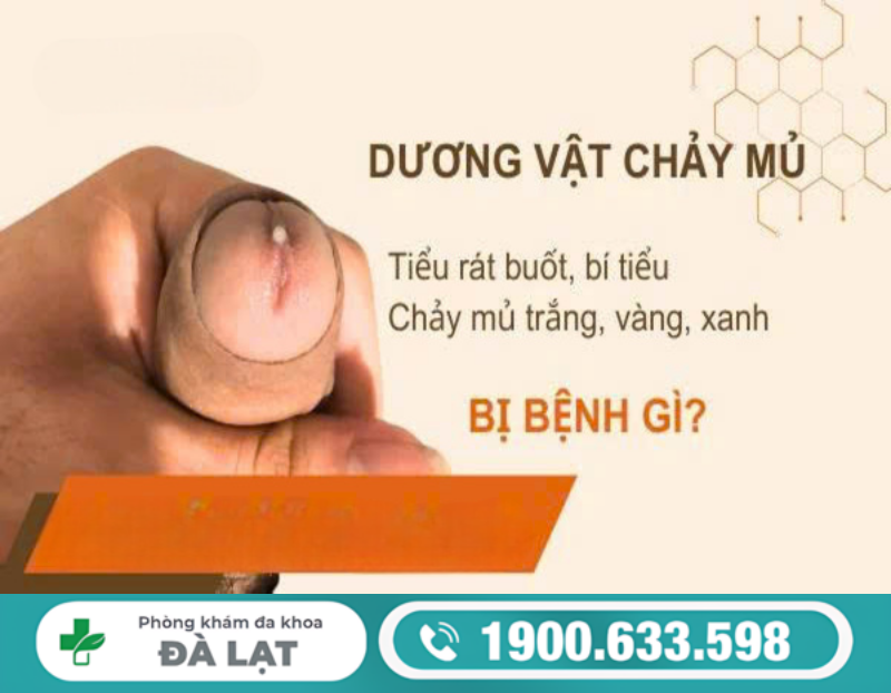 NGUYÊN NHÂN KHIẾN DƯƠNG VẬT CÓ MỦ VÀNG Ở NAM GIỚI