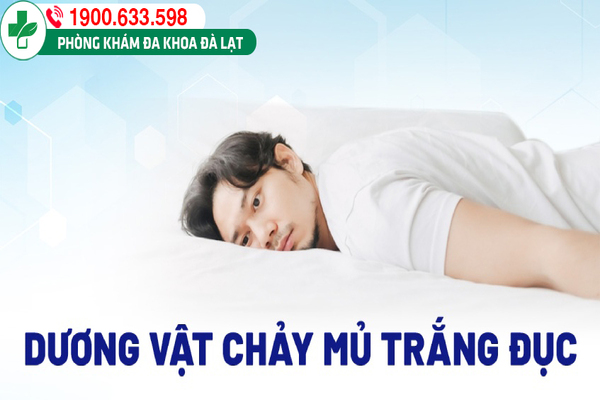 DƯƠNG VẬT CÓ MỦ TRẮNG Ở: KHI NÀO NAM GIỚI CẦN ĐI KHÁM?