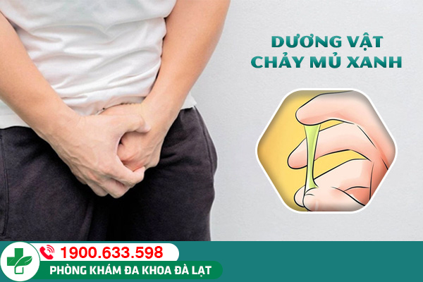 DƯƠNG VẬT CÓ MỦ XANH Ở NAM GIỚI: BỆNH LÝ NGUY HIỂM CẦN CẢNH GIÁC