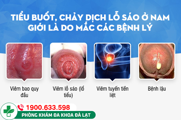 VIÊM LỖ SÁO: DẤU HIỆU CẢNH BÁO CÁC BỆNH NAM KHOA NGUY HIỂM 