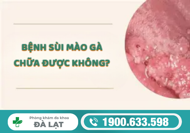 CÁCH CHỮA BỆNH SÙI MÀO GÀ Ở NAM GIỚI 