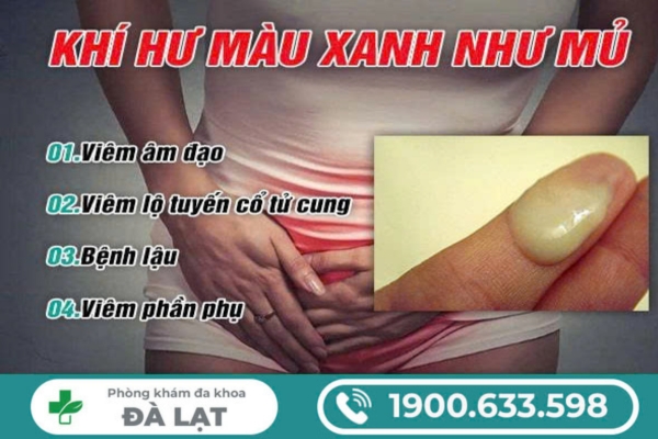 Khí Hư Màu Xanh Như Mủ 