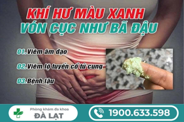 Khí Hư Màu Xanh Vón Cục Như Bã Đậu Cảnh Báo Bệnh Gì? 