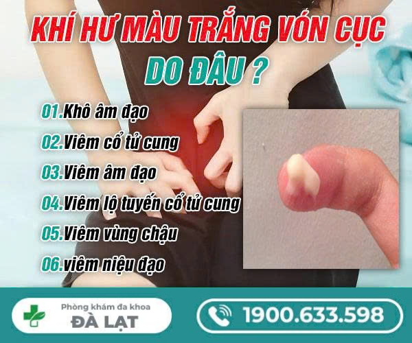Khí Hư Màu Trắng Đục Có Vón Cục Cảnh Báo Bệnh Lý Nguy Hiểm Nào? 