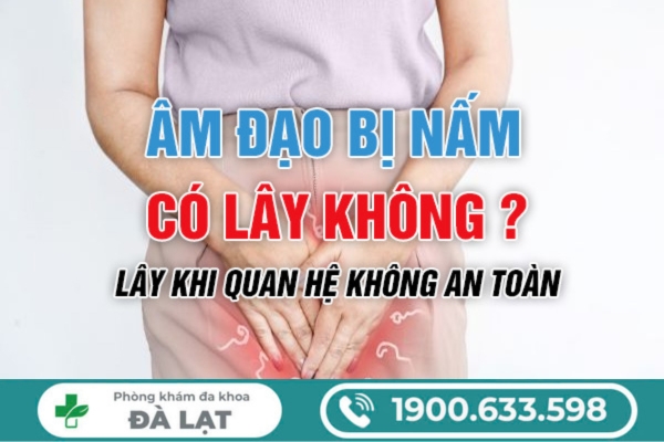 Bị Nấm Âm Đạo Có Bị Lây Không? 
