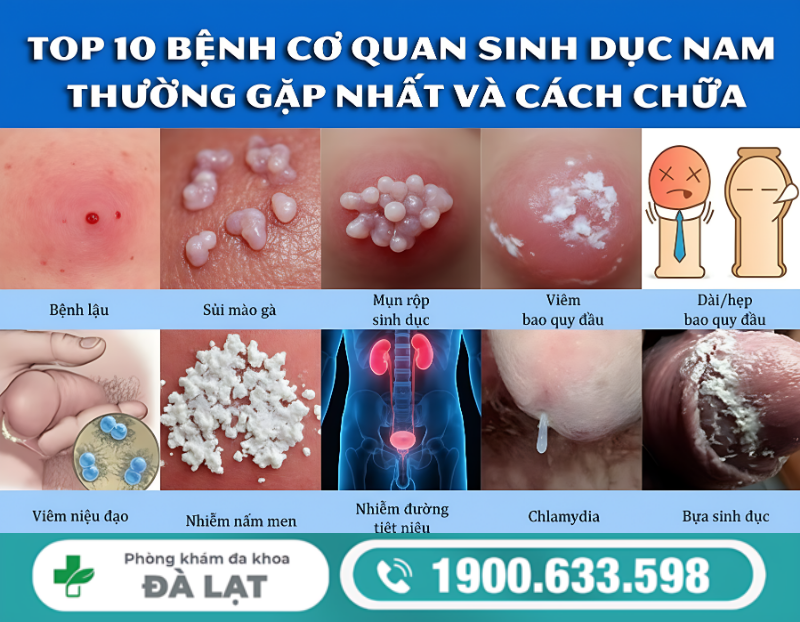 BỘ PHẬN SINH DỤC NAM BỊ ĐAU, NGỨA, SƯNG, LỞ LOÉT, CHẢY MÁU, NÓNG RÁT: DẤU HIỆU BỆNH LÝ NGUY HIỂM