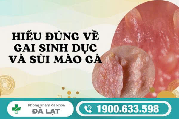 BỆNH GAI SINH DỤC Ở NAM GIỚI CÓ NGUY HIỂM KHÔNG? BÁC SĨ GIẢI THÍCH CHI TIẾT 