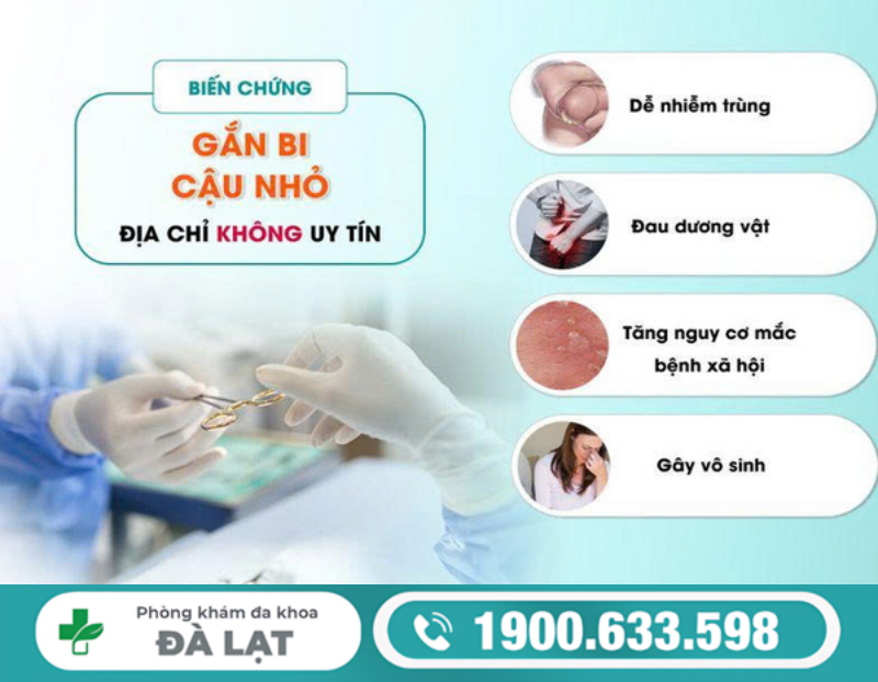 GẮN BI DƯƠNG VẬT: GỢI Ý ĐỊA CHỈ UY TÍN NAM GIỚI NÊN LỰA CHỌN