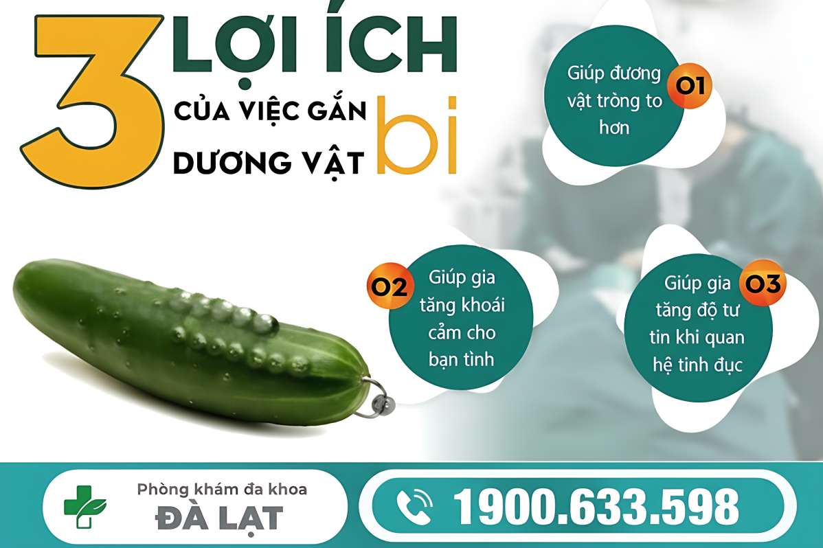 GẮN BI DƯƠNG VẬT: GIẢI PHÁP CẢI THIỆN CHO NAM GIỚI 