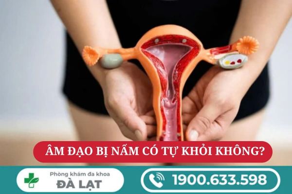 Nấm Âm Đạo Có Tự Khỏi Không? 
