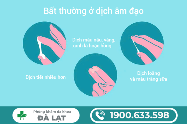 Ngứa vùng kín ra dịch trắng ở cô bé có sao không ?