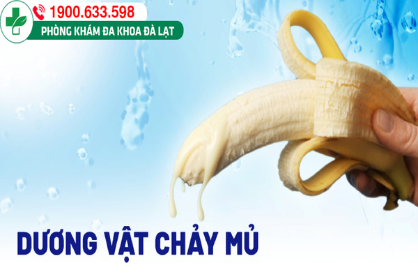 NAM GIỚI RA DỊCH TRẮNG LÀ HIỆN TƯỢNG GÌ