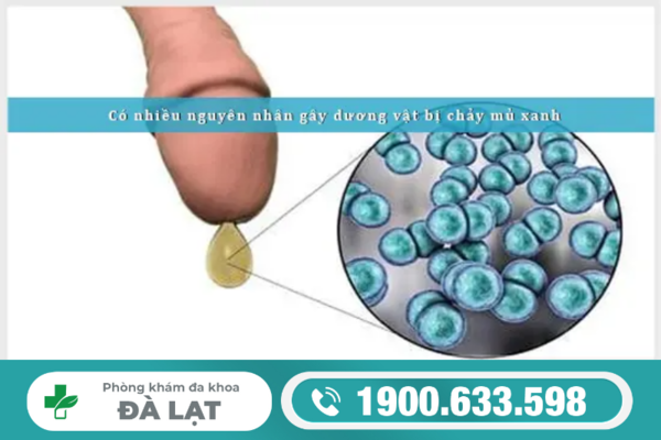 NAM GIỚI BỊ RA DỊCH MÀU XANH SAU KHI QUAN HỆ