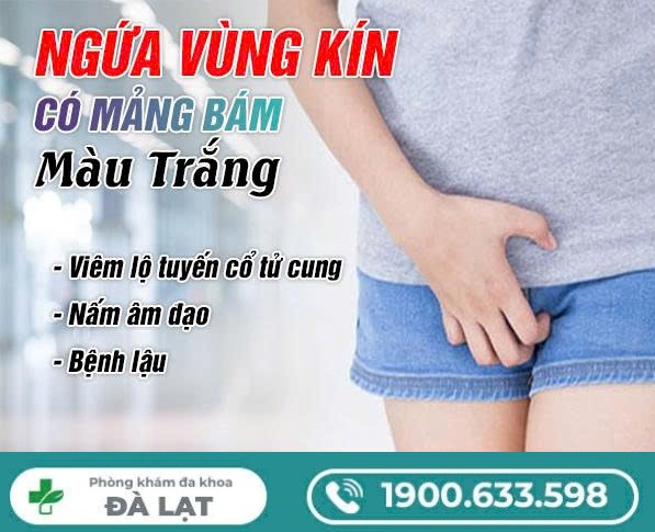 Ngứa Vùng Kín Và Có Mảng Bám Màu Trắng 